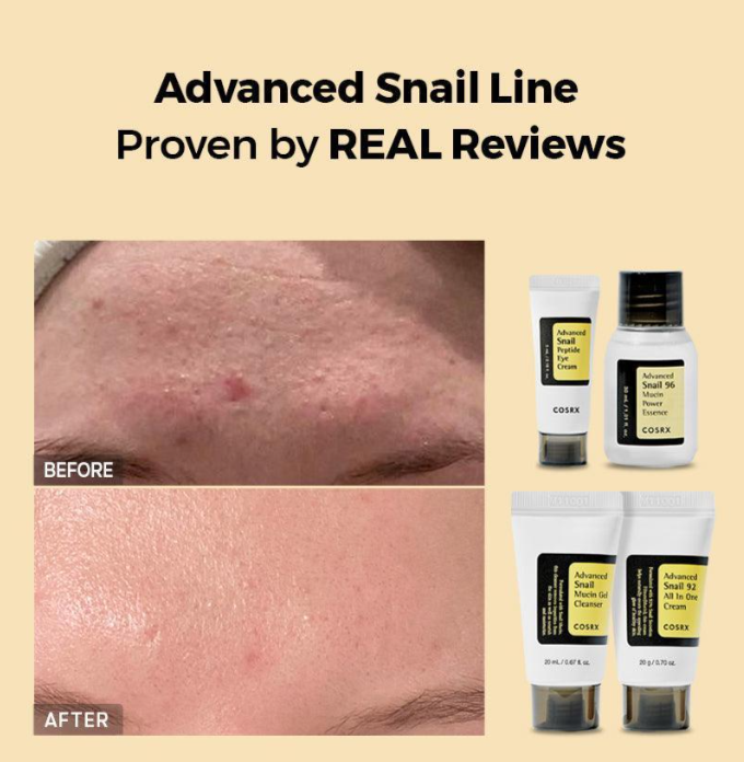 COSRX All About Snail Kit β Complete Snail Mucin Skincare Set