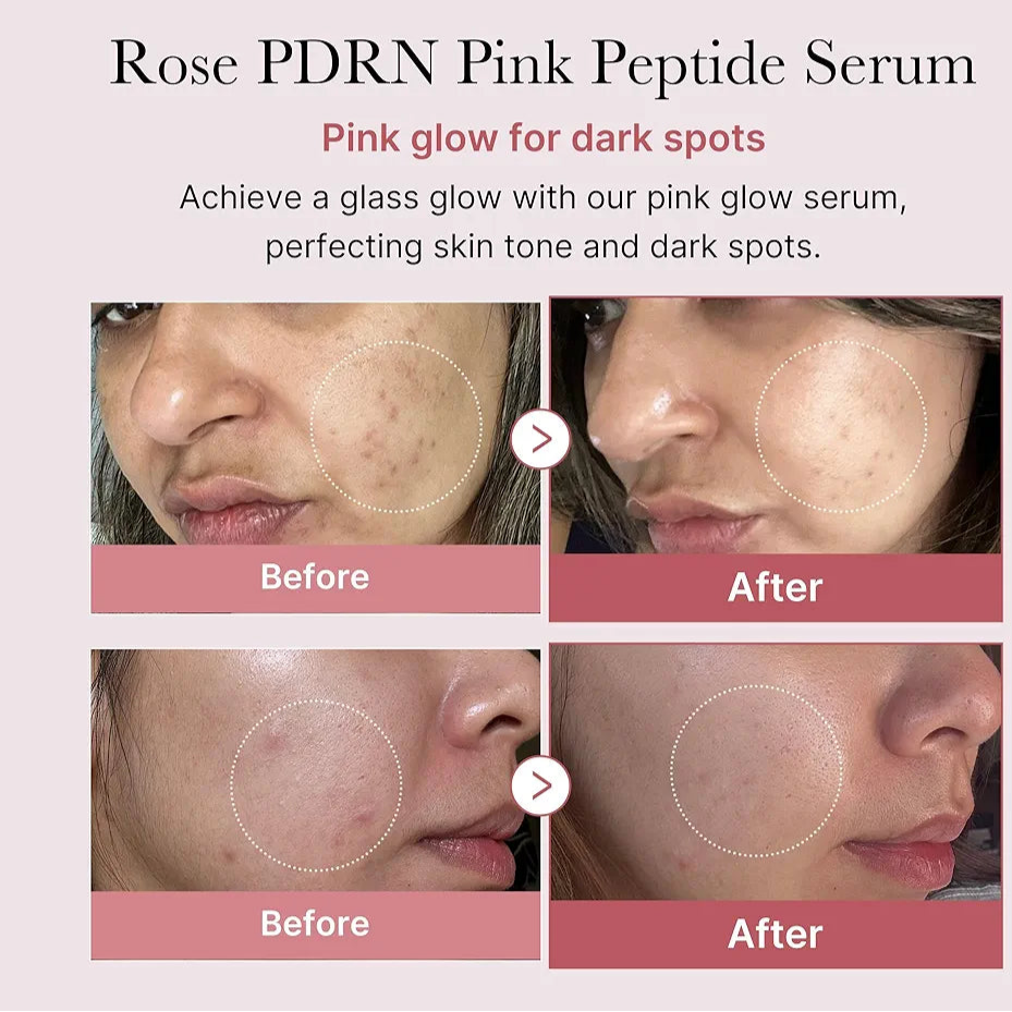 Medicube PDRN pdrn Pink Peptide Serum 30ml