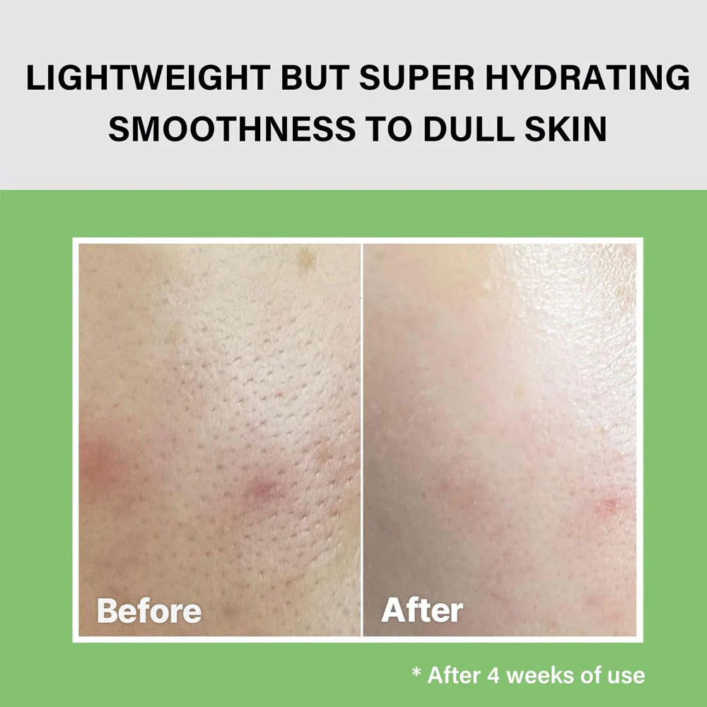 celimax The Real Noni Moisture Balancing Toner 150ml