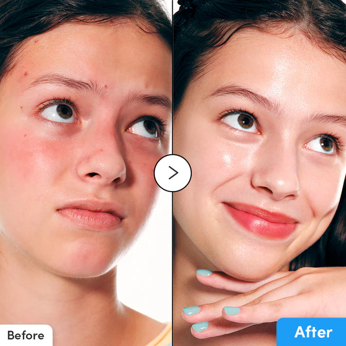 Eqqualberry - Blue Blow Hyaltoin Flooding Serum - 30ml