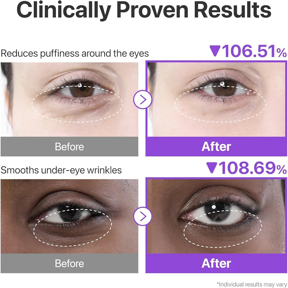 Numbuzin No.9 NAD+ Collagen Under Eye Patches 8g x 5 pairs