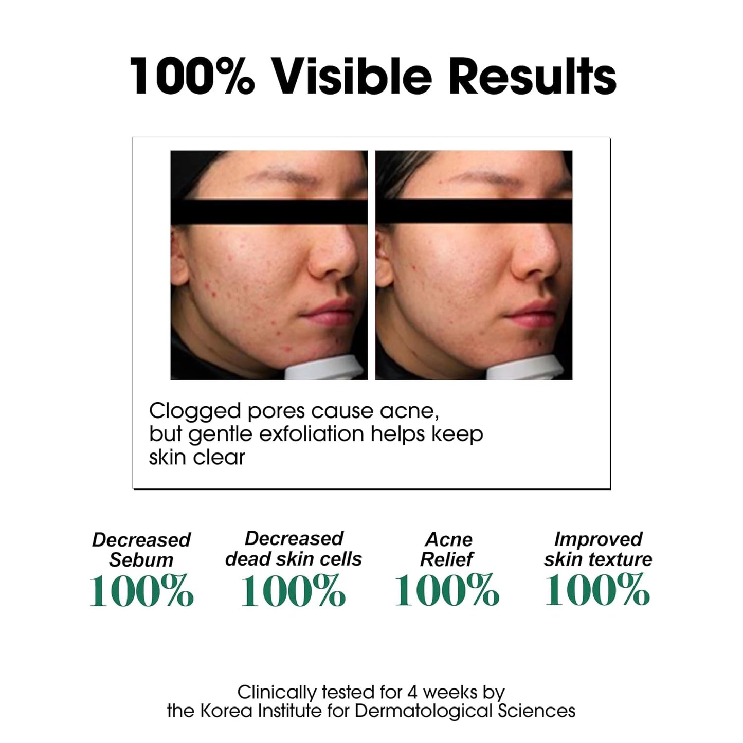 SOME BY MI AHA BHA PHA 30 Days Miracle Toner - 150ML