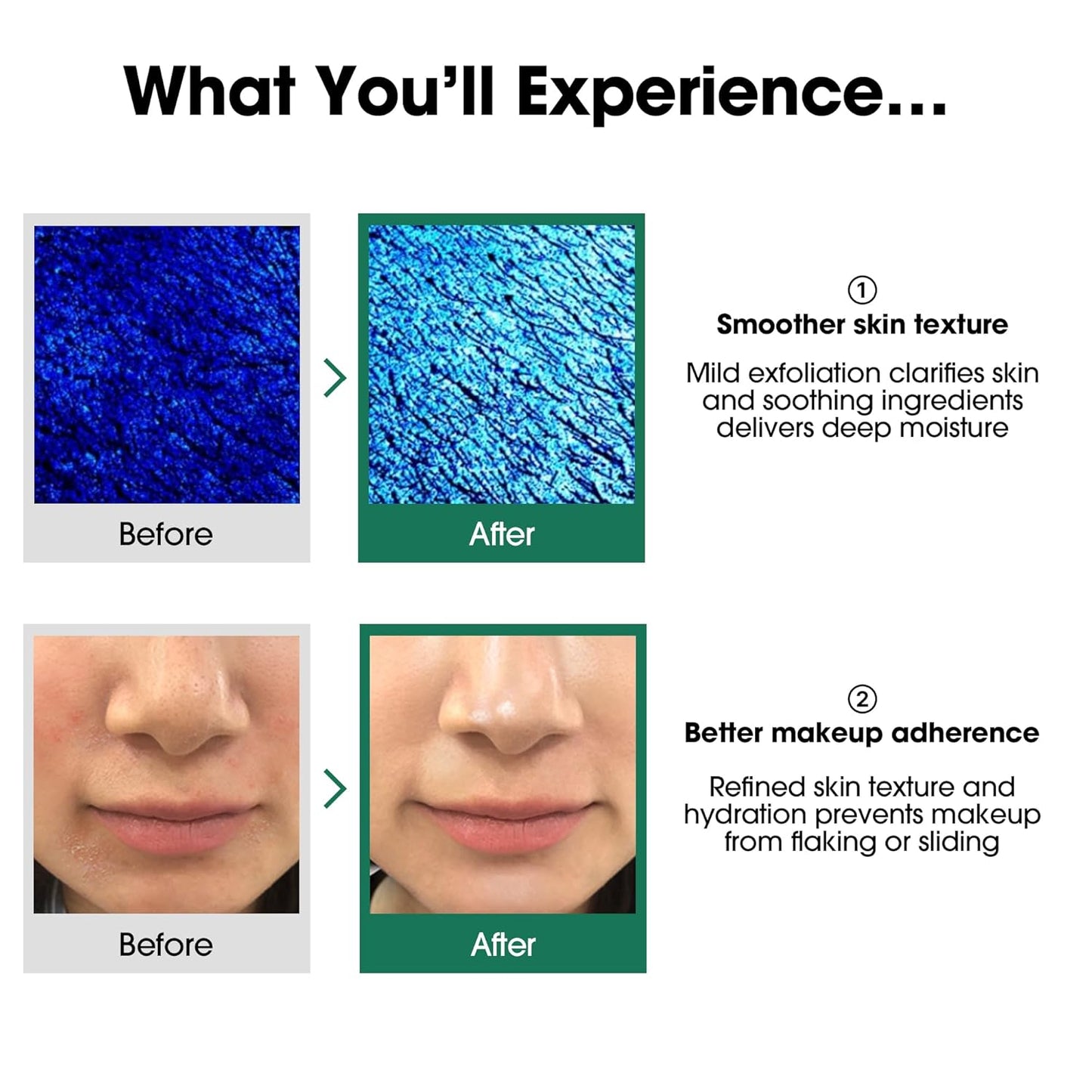 SOME BY MI AHA BHA PHA 30 Days Miracle Toner - 150ML