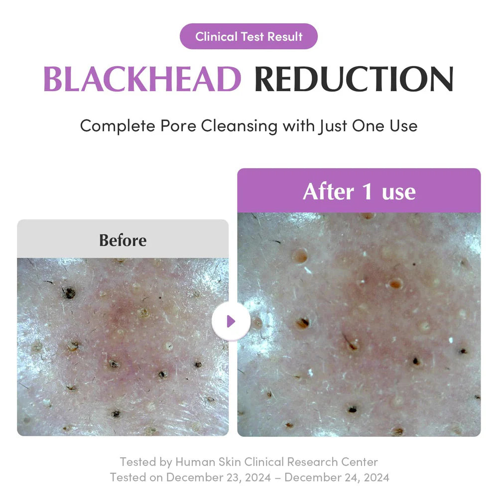 EQQUALBERRY Purple Rice Pore Purifying Pack Cleanser 130g