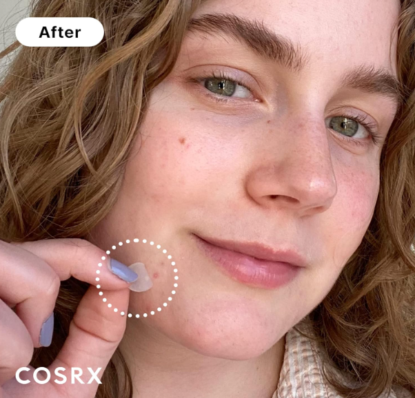 COSRX Acne Pimple Master Patch